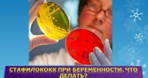 Сапрофитный стафилококк при беременности