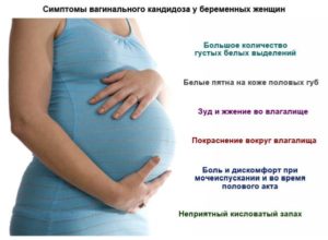 20 неделя беременности молочница