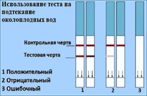 Признаки подтекание околоплодных вод на 24 неделе беременности