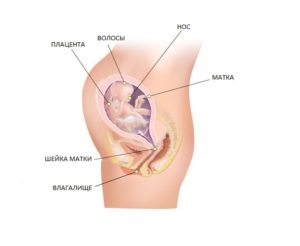 Матка на 25 неделе беременности