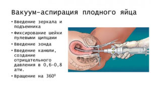 Антибиотики после вакуумной аспирации