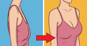 Что делать с обвисшей грудью