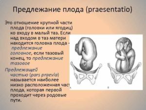 Предлежание головка это как