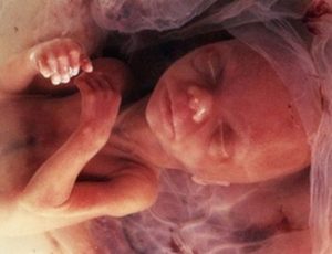 Можно ли на 13 неделе чувствовать шевеления