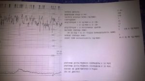 Шевеления плода на 39 неделе беременности норма