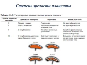 Степень зрелости плаценты на 32 неделе беременности 2