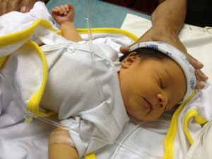 Опасна ли желтушка у новорожденных