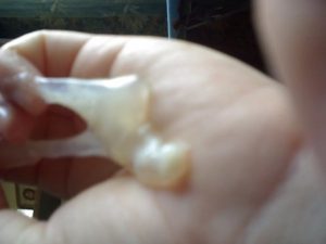 Могут ли отойти воды если пробка не отошла