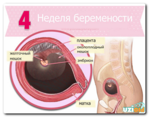 На какой неделе беременности прикрепляется плод к матке