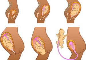 Как матка растет при беременности