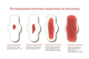 После родов кровь сколько