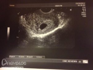 На узи не видно эмбриона срок 5 недель