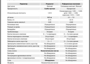 Соль в моче при беременности что это значит