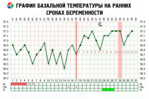 Температура 37 4 при беременности на ранних сроках