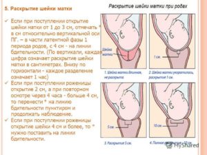 Как шейка готовится к родам