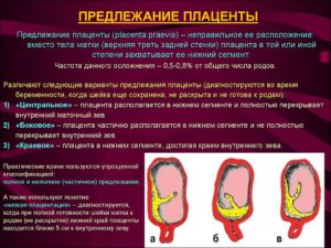 Плацента по задней стенке перекрывает внутренний зев