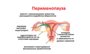 Месячные при начале климакса