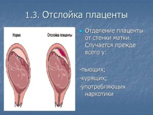 Отслойка плаценты на ранних сроках беременности лечение последствия