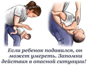 Что делать если малыш подавился