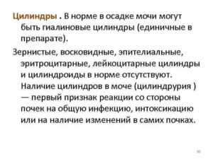 Норма цилиндров в моче