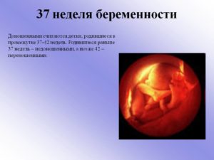 37 недель беременности ребенок доношенный