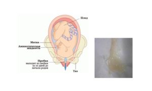 Как понять что отошла слизистая пробка при беременности