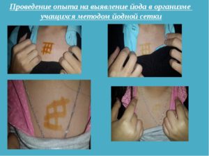 Можно ли делать йодовую сетку на горло беременным