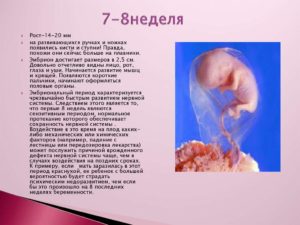 Размер плода 7 недель