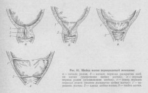 Какая шейка матки перед родами