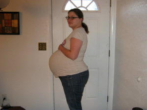 Двойня беременность 35 недель
