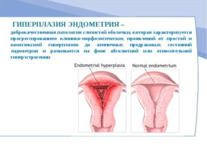При климаксе разрастание эндометрия