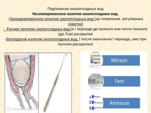 Подтекание околоплодных вод признаки на 40 неделе беременности