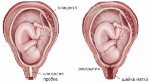 Как понять что отошла слизистая пробка при беременности