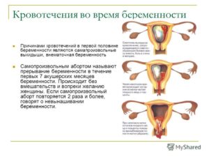 Могут ли идти месячные при начальной стадии беременности