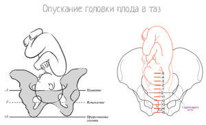 Головка плода низко опущена