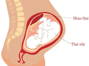 Толстая плацента при беременности