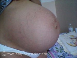 40 неделя беременности грудь болит