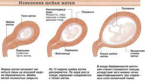 Матка до беременности и во время беременности