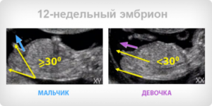 Можно узнать пол ребенка на 12 недели беременности
