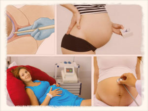 Как побриться беременной самостоятельно