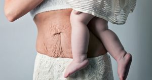 Тело женщины после родов