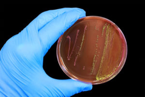 Escherichia coli у беременных