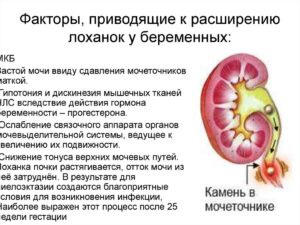 При беременности расширение лоханки