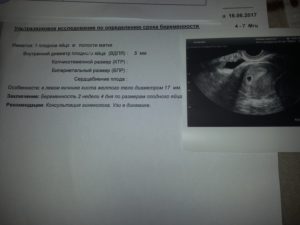 На какой неделе можно определить по узи беременность