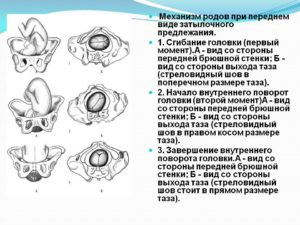 Головка прорезывается при переднем виде затылочного предлежания