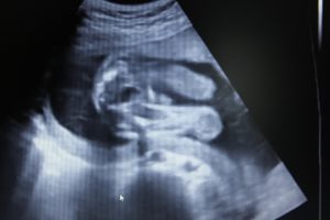 Беременности 21 неделя мальчик