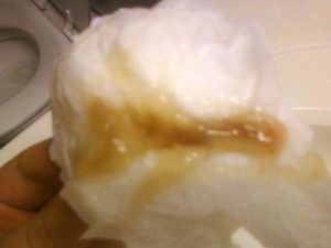 Могут ли отойти воды если пробка не отошла