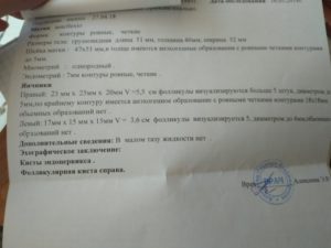 Утрожестан подавляет ли овуляцию