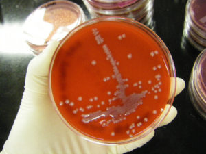 Escherichia coli у беременных