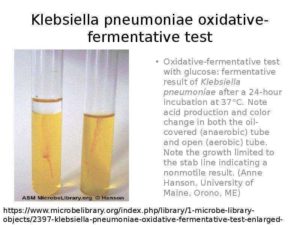 Klebsiella pneumoniae 10 в 3 степени в моче